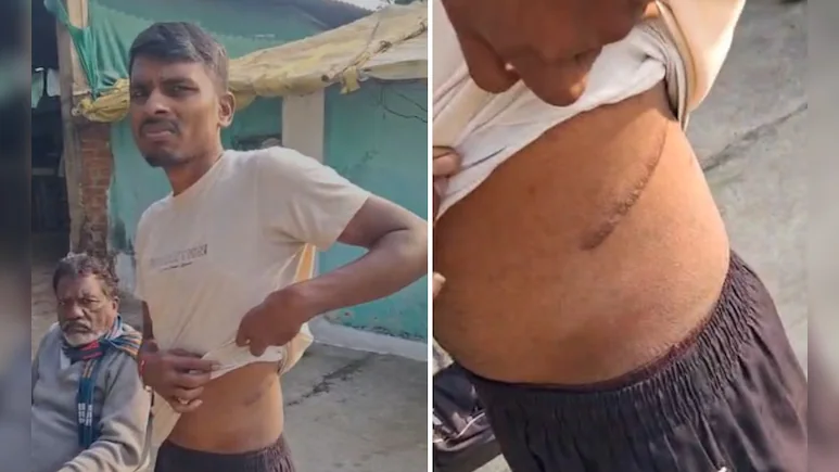 Chanderpur, Maharashtra farmer whose kidney was sold