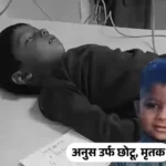 Agra 5 year old boy dies of rabies dog bite vaccine failure Pinahat news