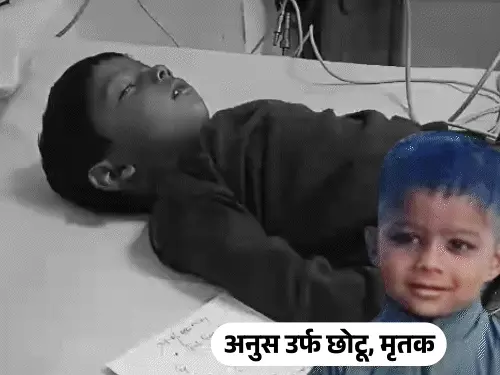Agra 5 year old boy dies of rabies dog bite vaccine failure Pinahat news