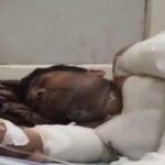 आगरा के शाहगंज में ऑटो चालक को जिंदा जलाने का प्रयास