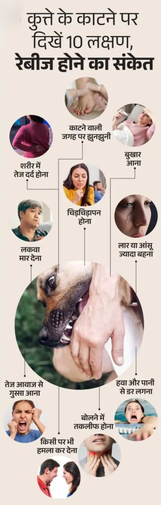 Rabies Injection after dog bite