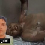प्रेमिका ने पेट्रोल डालकर प्रेमी को जलाया