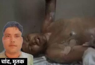 प्रेमिका ने पेट्रोल डालकर प्रेमी को जलाया