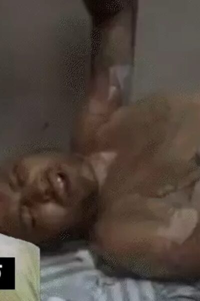 प्रेमिका ने पेट्रोल डालकर प्रेमी को जलाया