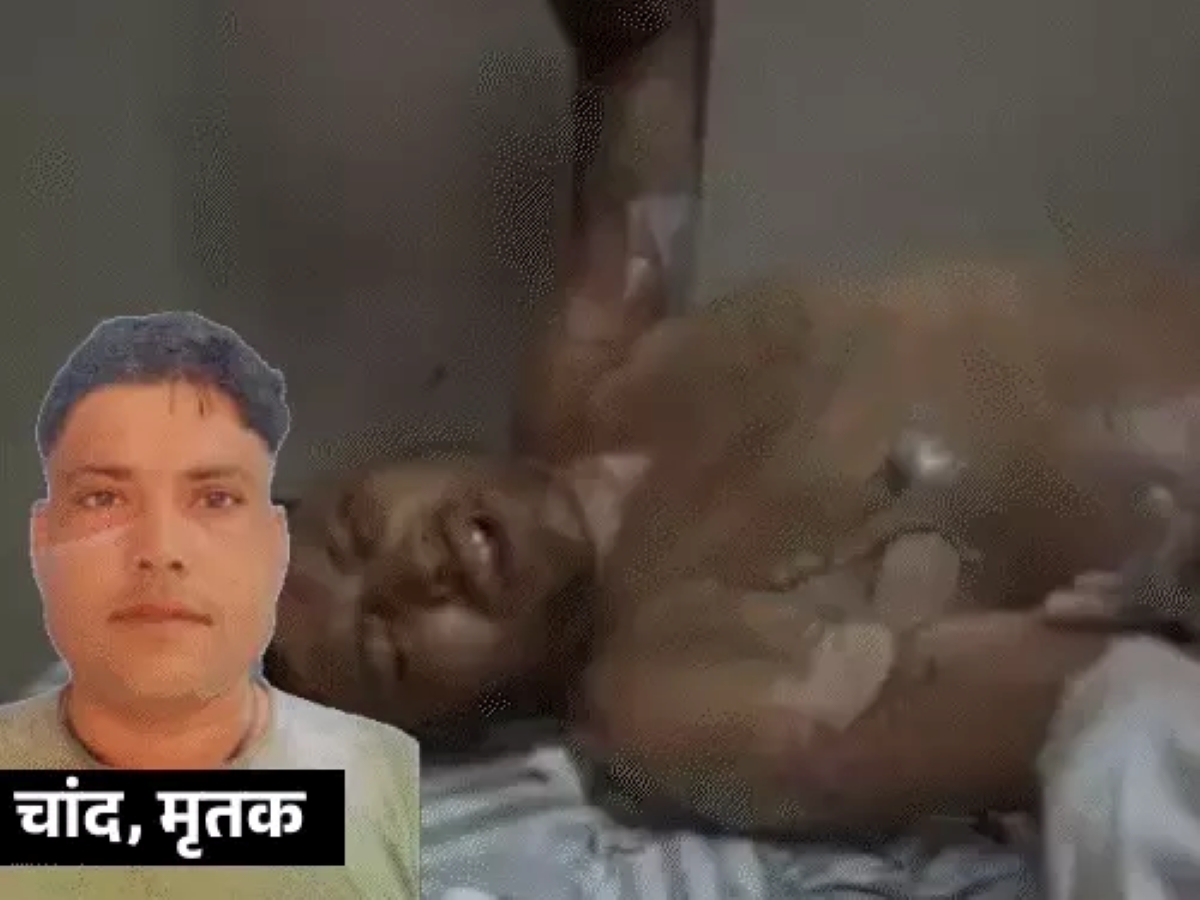 प्रेमिका ने पेट्रोल डालकर प्रेमी को जलाया